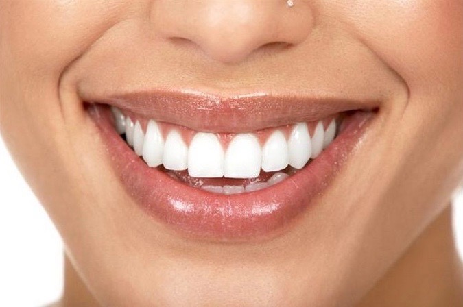 airalia dientes blancos 1