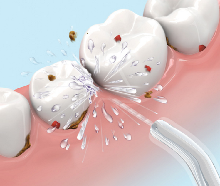 airalia irrigador dental agua