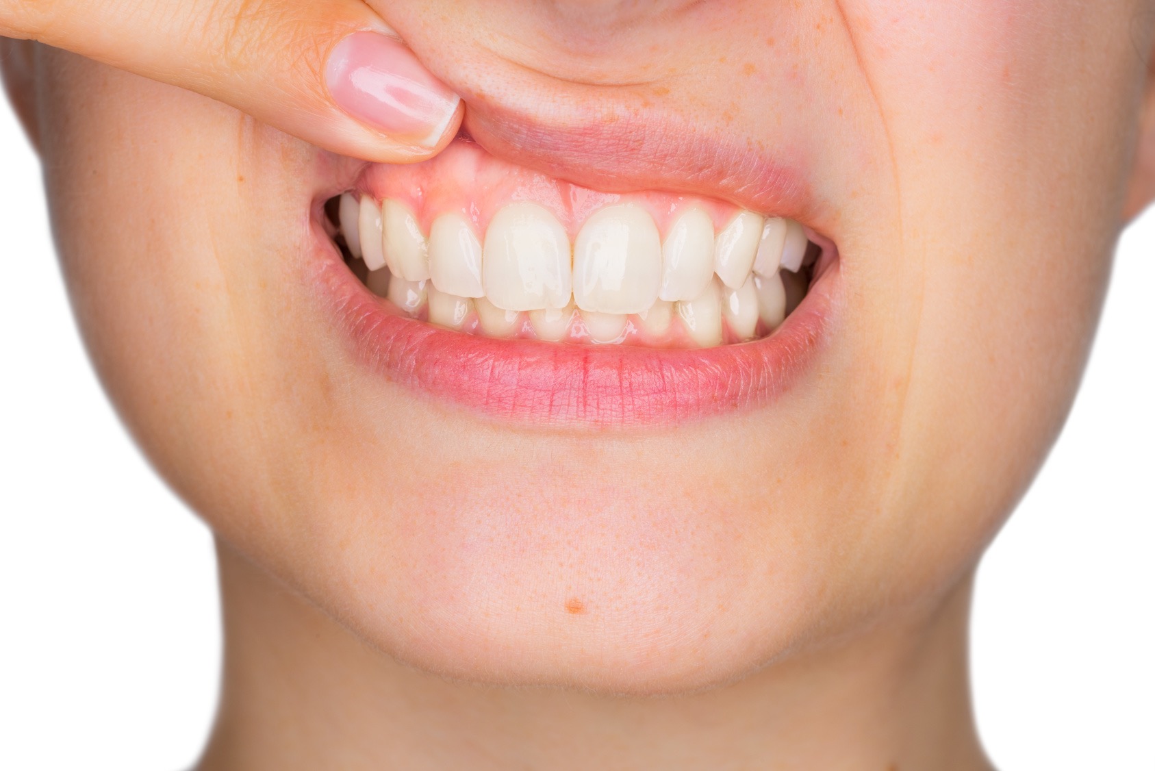 airalia salud dientes